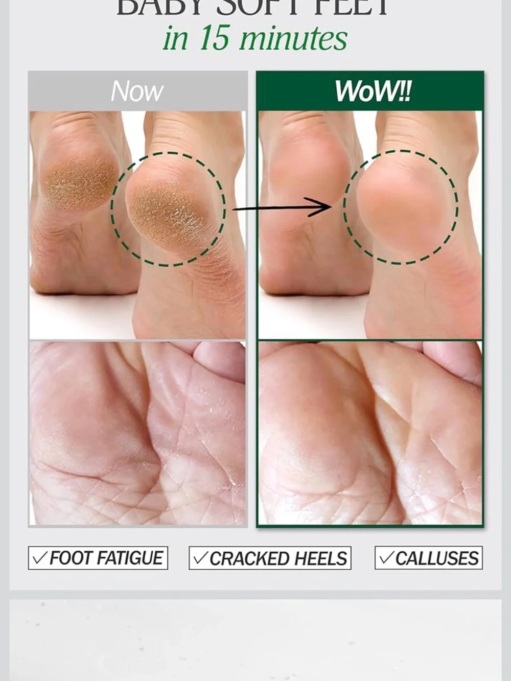 TODAYADAY Foot Spa Foot Mask Socks Hypoallergenic Cracked Heels 5pcs 16g